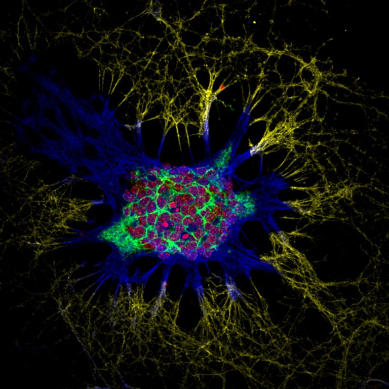 Neurones d’un hippocampe de souris