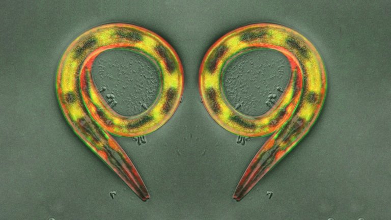 Vers nématodes adultes infectés par un champignon et observés en fluorescence et microscope à contraste interférentiel. 