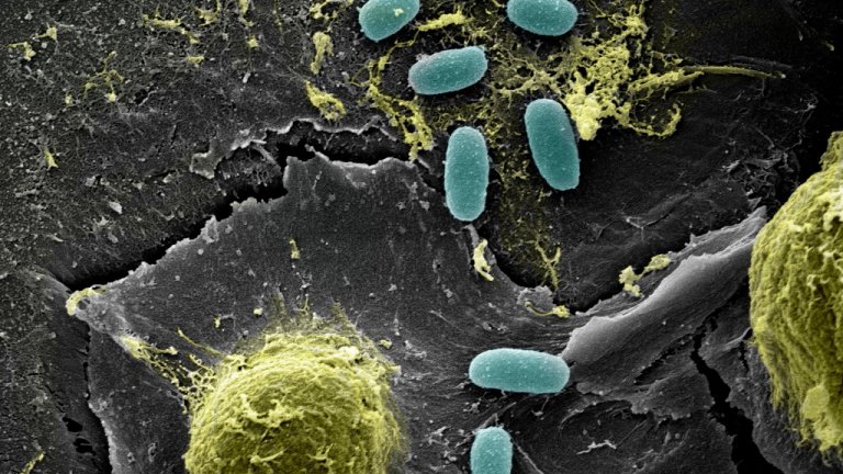 Microplastique couvert de communautés bactériennes, observé en microscopie électronique à balayage. L’image est colorisée. 