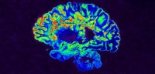 Image IRM en fausses couleurs d’un hémisphère cérébral de personne atteinte de sclérose en plaques (les zones lésées sont en rouge). © Govind Bhagavatheeshwaran, Daniel Reich / NINDS / NIH