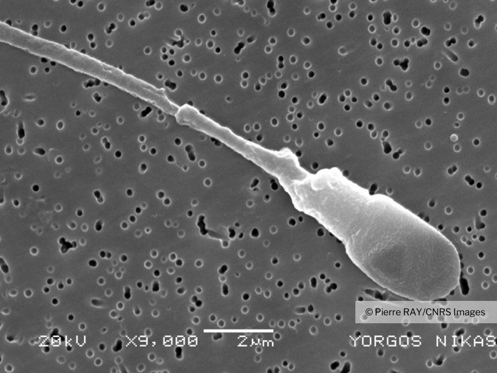 Spermatozoïde Témoin Observé Au Microscope électronique à Balayage Dans