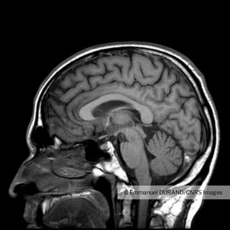 Image d'une coupe sagittale de cerveau humain obtenue en IRM ...